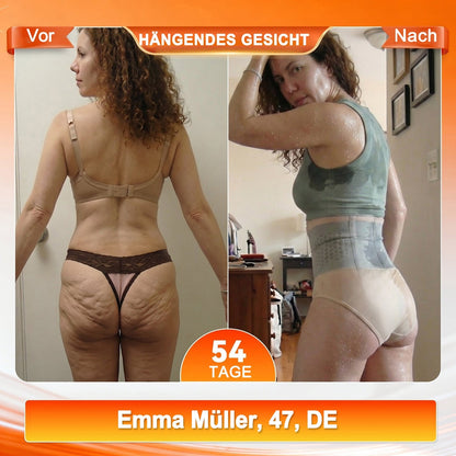 👙 Offizieller Markenstore | Von𝐮𝐭𝐫𝐢® 2026 Moringa & Berberin 4-in-1 Mikropartikel Sculpting & Fettverbrennende Shorts